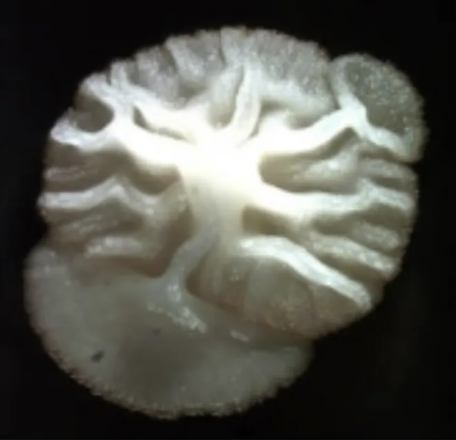 Yeast colony showing unstable colony morphology